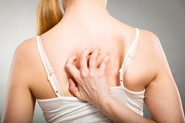 when to consult a doctor regarding back acne?