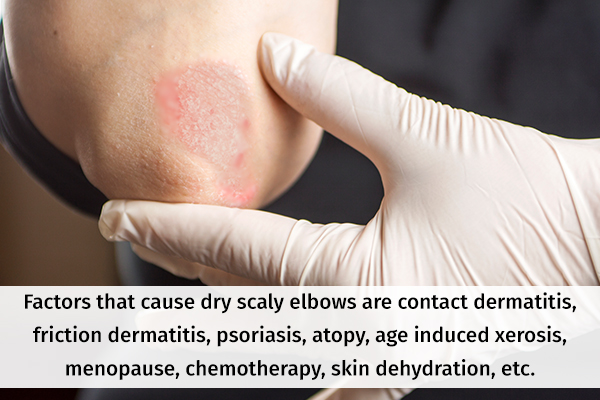 factors that can cause dry, scaly elbows