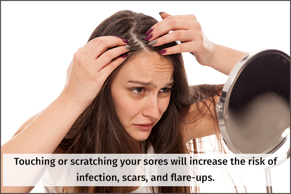 don't touch or scratch your scalp sores