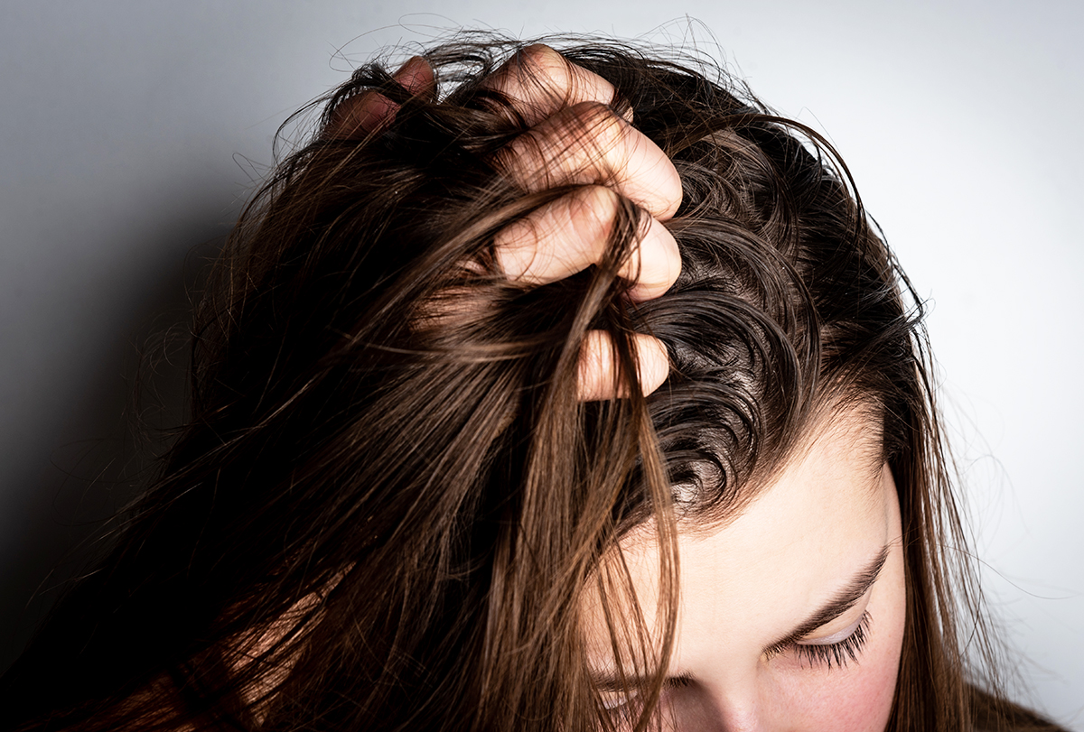 4 Telltale signs that you have an oily scalp and treatment  Bee Choo  Ladies