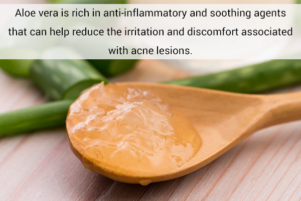 aloe vera for soothing chest acne