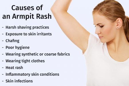 Armpit Rash: Causes, Symptoms, & Treatment Options