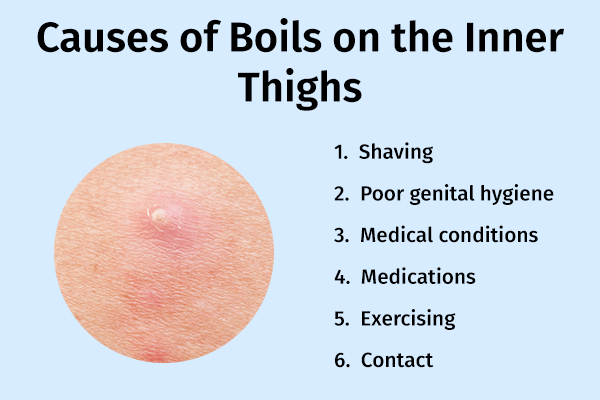 causes behind boils on inner thighs