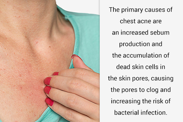 causes/factors responsible for chest acne