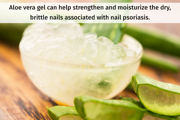 aloe vera gel can help with nail psoriasis