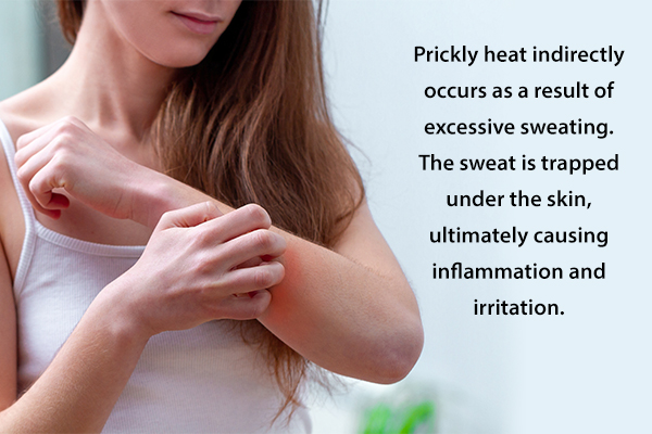 prickly heat causes