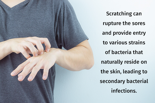 complications of unresolved scabies