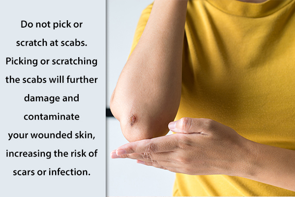 don't pick or scratch your scabs to ensure recovery