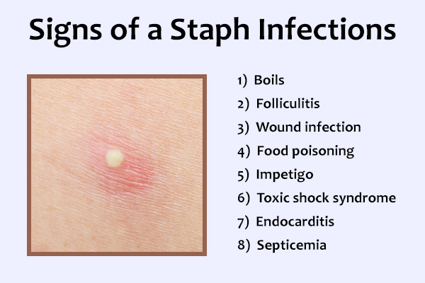 signs and symptoms of staph infections