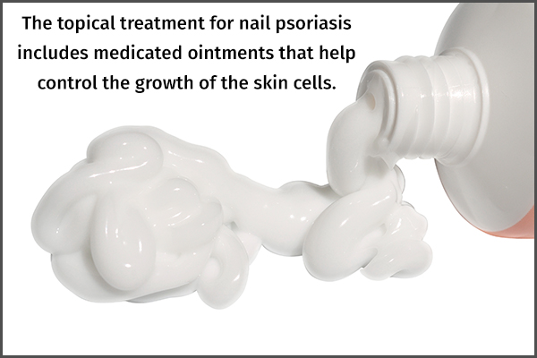 topical treatment options for nail psoriasis
