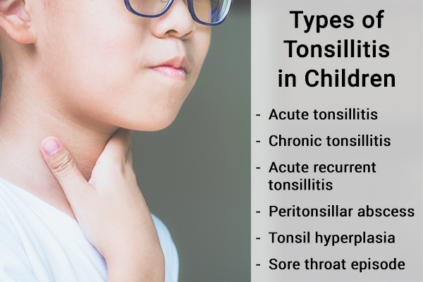 Tonsillitis Treatment