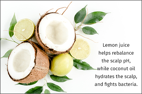 coconut oil, lemon juice can help manage dandruff