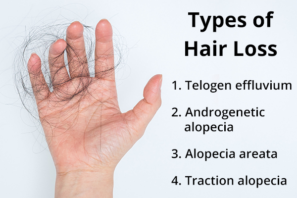 hair loss types