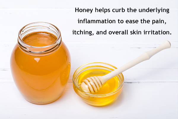 honey usage can help manage angular cheilitis