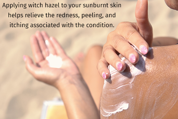 applying witch hazel can help heal sunburnt skin
