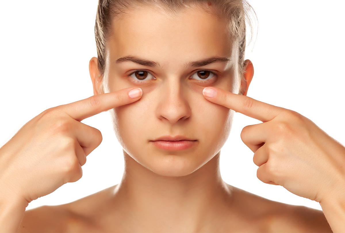 under-eye bags: causes and treatment