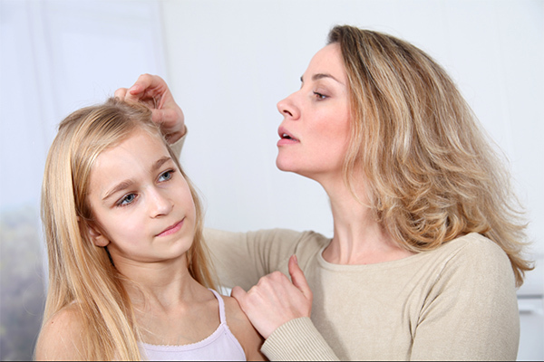 coconut oil application can help control hair lice infestation
