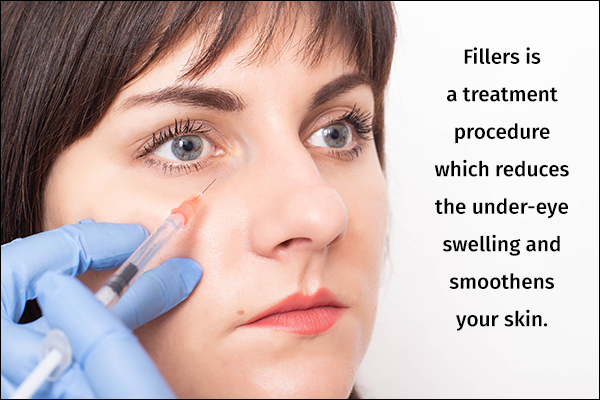 fillers are used to treat under-eye bags