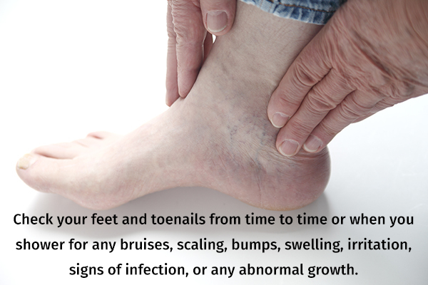 self-examine your feet to check for any foot issues