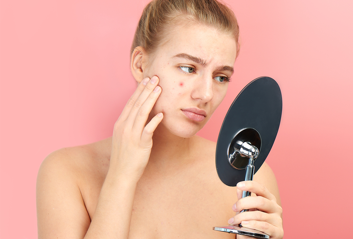pimple redness: causes and treatments