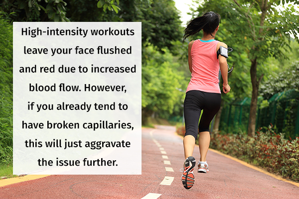 mild-exercises can help reduce risk of broken capillaries