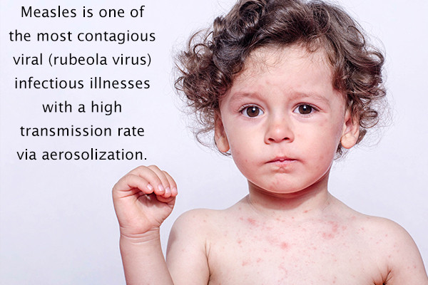measles is a contagious illness in children
