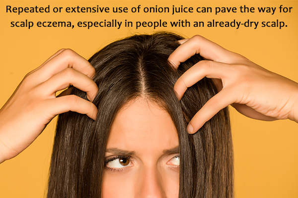 extensive usage of onion juice on hair can lead to scalp eczema