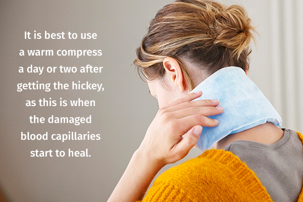 using a warm compress can help heal hickeys and bruises