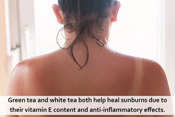 tea bags can be recycled and can help heal razor burns and sunburns