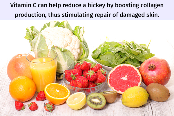 vitamin C can help reduce a hickey and repair skin damage