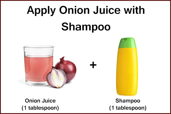 try adding onion juice to your shampoo