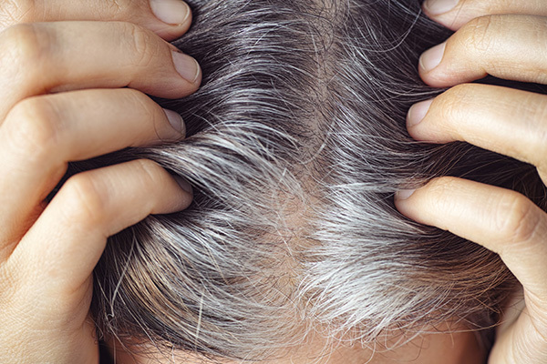 can smoking contribute to graying of hair?