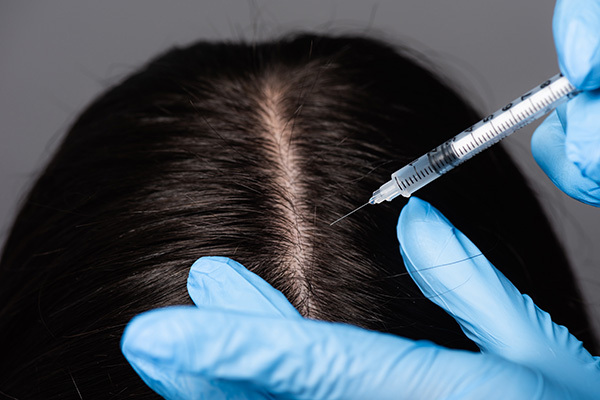 surgical and alternative treatment to reduce hair thinning