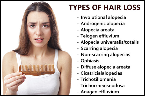 hair loss types