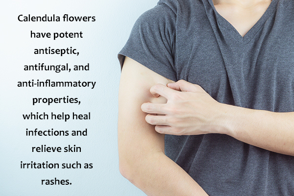calendula flowers can help soothe skin infections