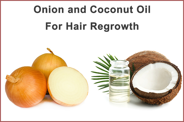 onion and coconut oil for hair regrowth