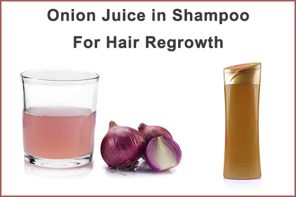 add onion juice in shampoo for hair regrowth