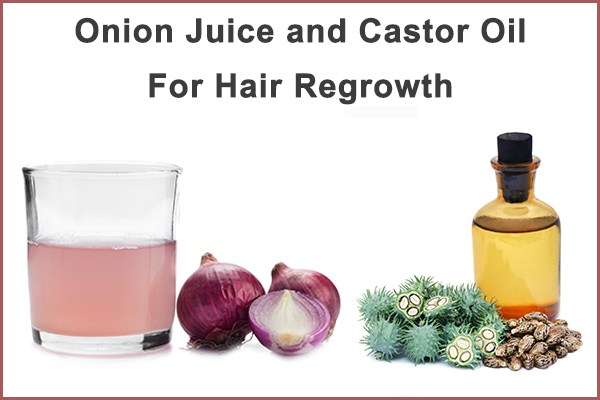 onion juice and castor oil for hair regrowth