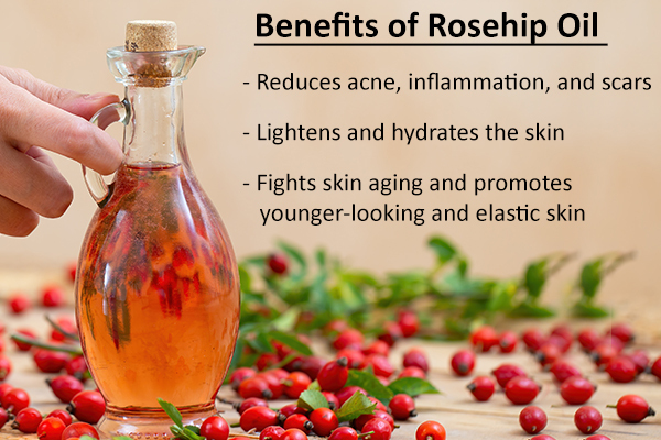 rosehip oil skin care benefits