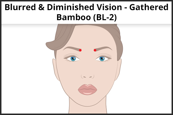acupressure point BL2 to help with blurred/diminished vision