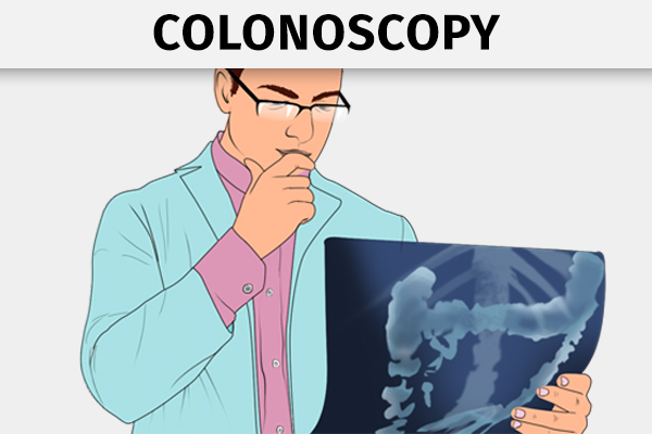 colonoscopy must be done regularly for men over age 40