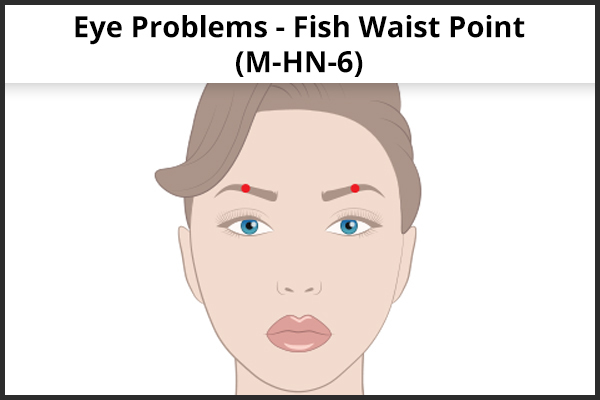 acupressure point MHN6 (Fish Waist) to relieve eye problems