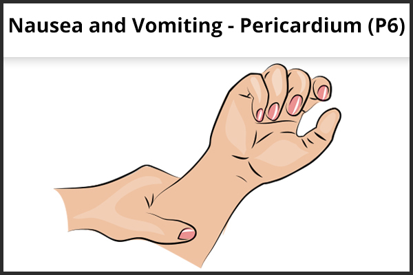 acupressure point P6 (Pericardium) to relieve nausea/vomiting
