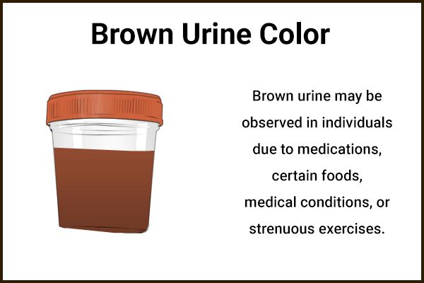 what health conditions can brown color urine represent?
