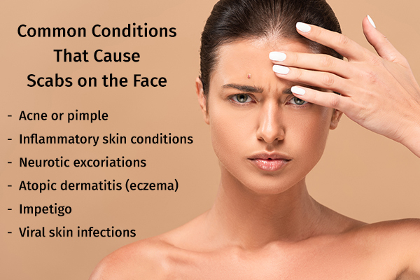 common skin conditions associated with scab formation