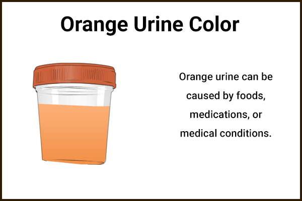 porphyria urine color