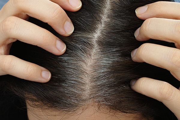 premature graying of hair causes