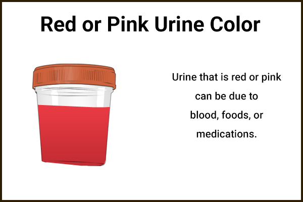 what ailments can red/pink color urine indicate?