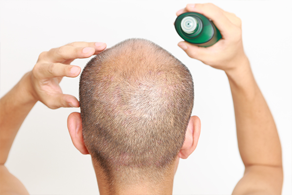 8 Home Remedies for Hair Growth in Men - eMediHealth
