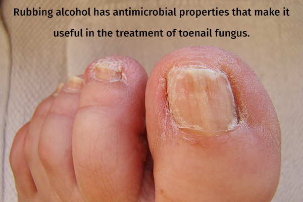 rubbing alcohol usage can be helpful in treating toenail fungus
